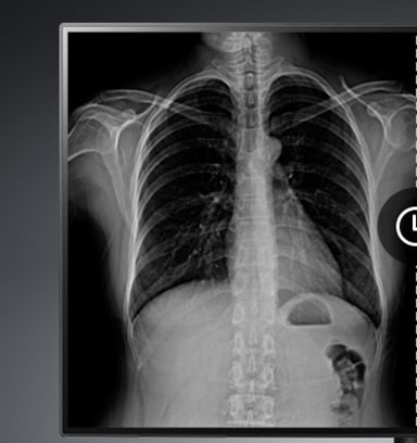 Conventional monitor display