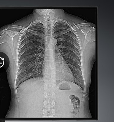 Brightness Stabilization monitor display