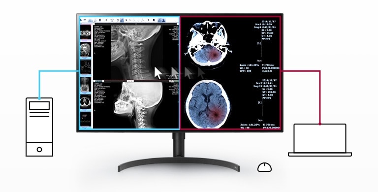 Multiple Signals on One Screen