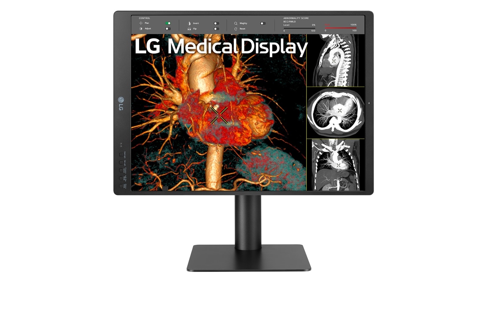 LG 21.3 (54.102 cm) 3MP IPS Diagnostic Monitor, 21HQ513D-B