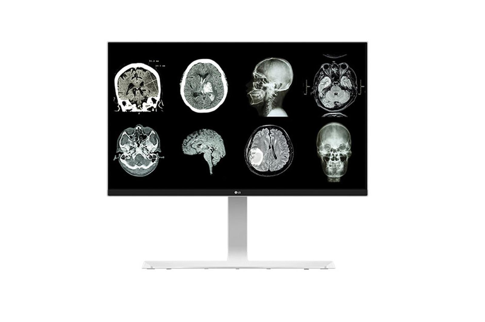 LG 27 (68.58cm) UHD 8MP Clinical Review Monitor, 27HJ712C-W