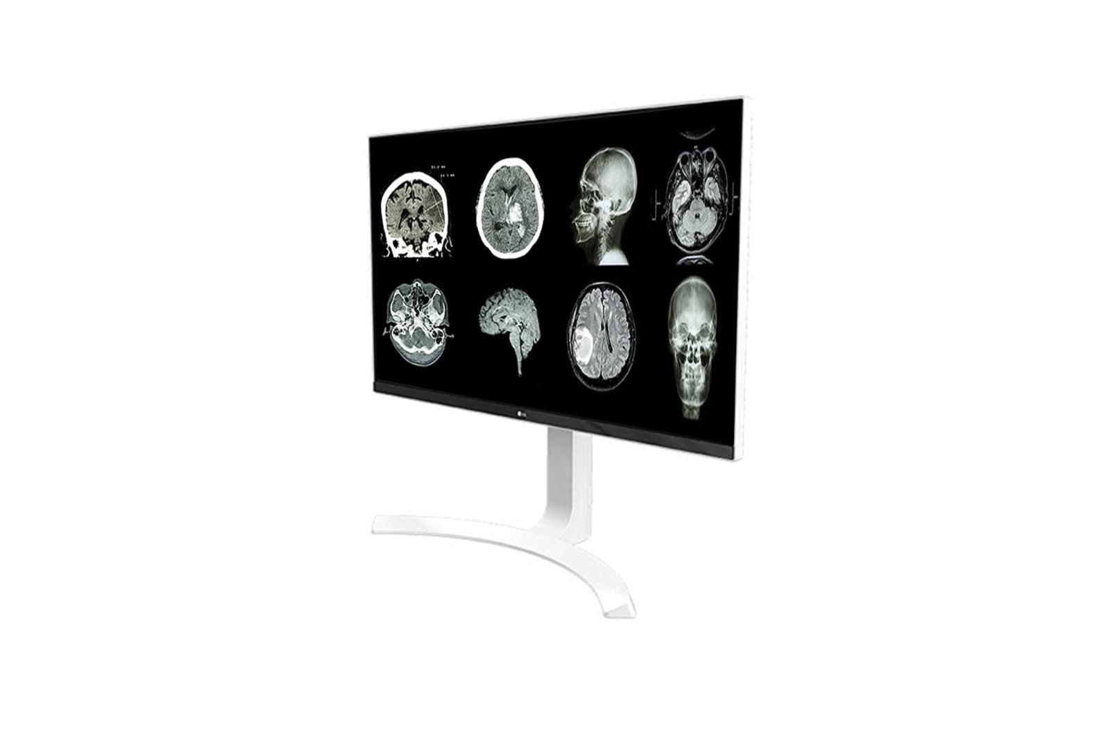 LG 27 (68.58cm) UHD 8MP Clinical Review Monitor, 27HJ712C-W