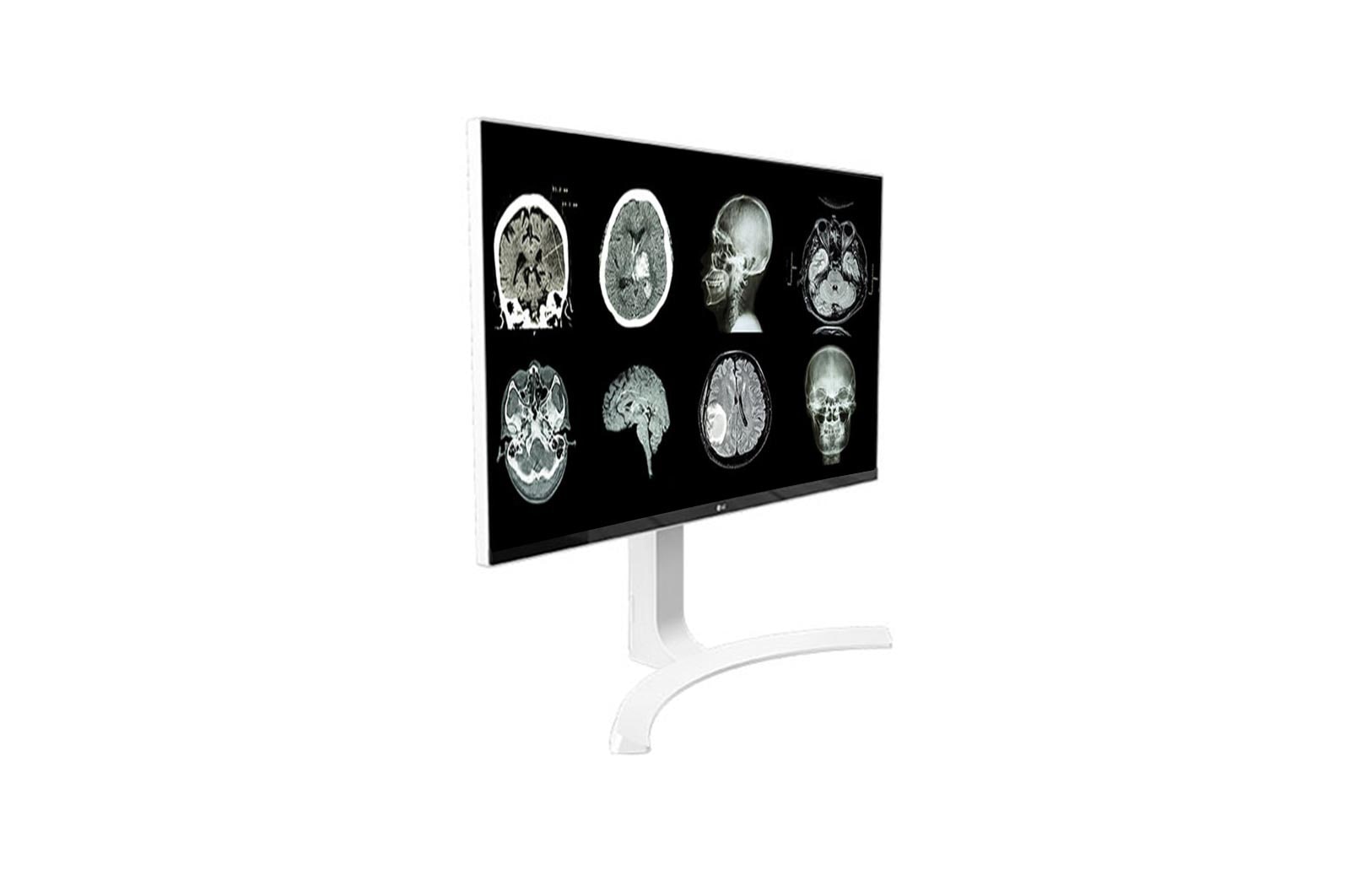 LG 27 (68.58cm) UHD 8MP Clinical Review Monitor, 27HJ712C-W