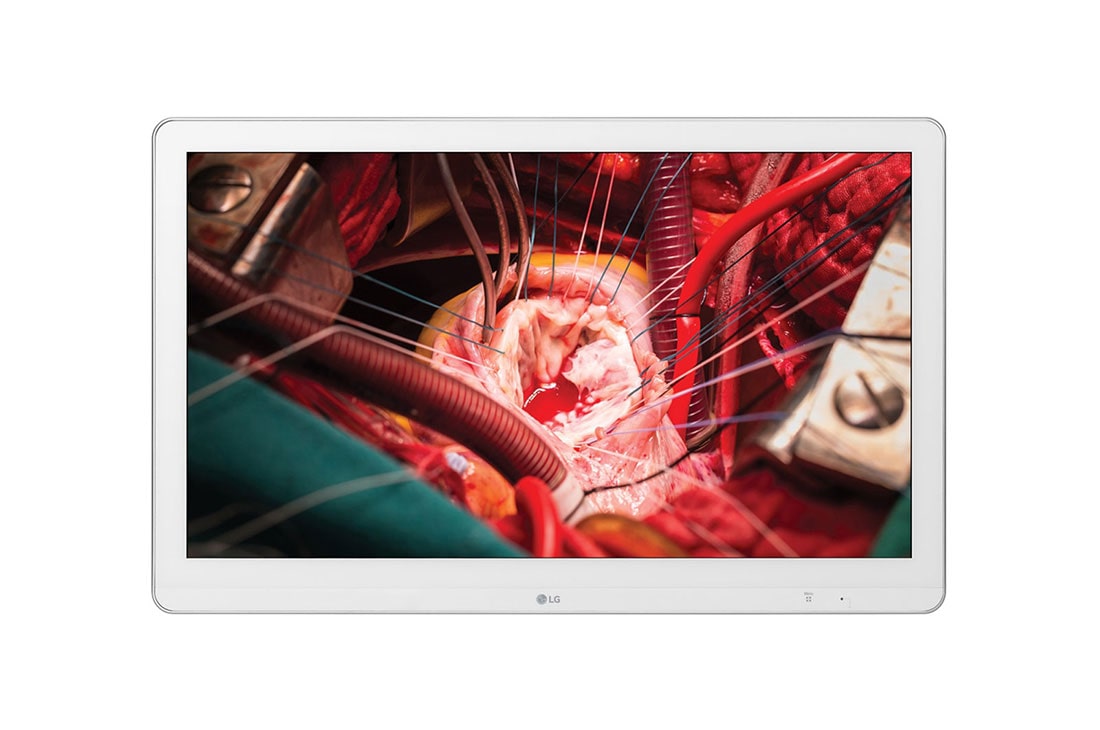 LG 27 (68.58cm) Full HD Surgical Monitor, 27HK510S-W