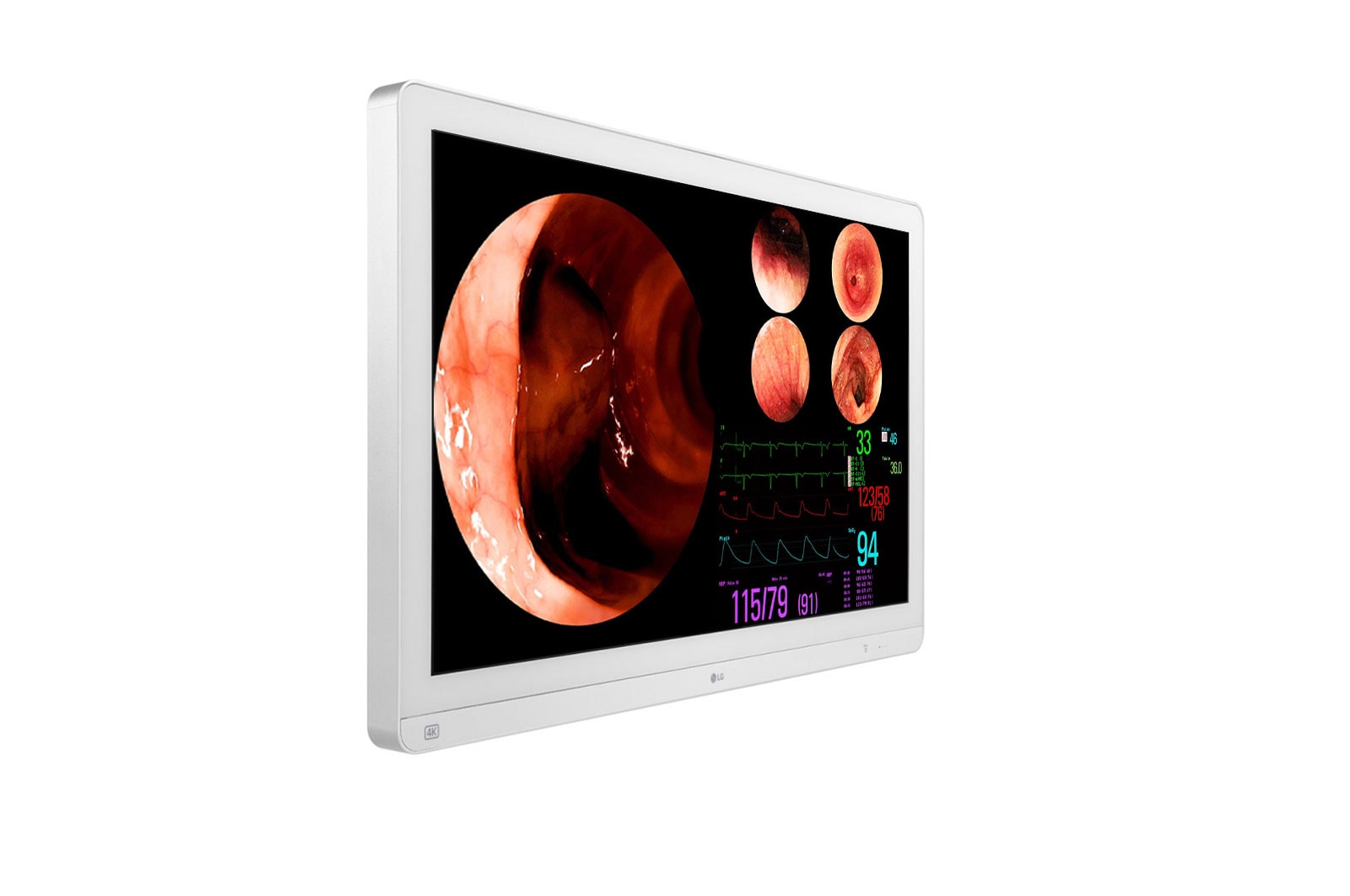 LG 31.5 (80.01cm) 4K IPS Surgical Monitor, 32HL710S-W