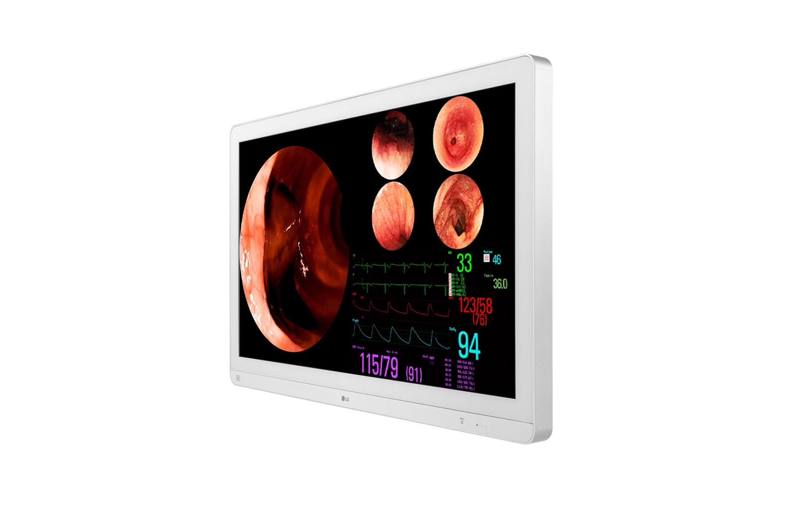 LG 31.5 (80.01cm) 4K IPS Surgical Monitor, 32HL710S-W