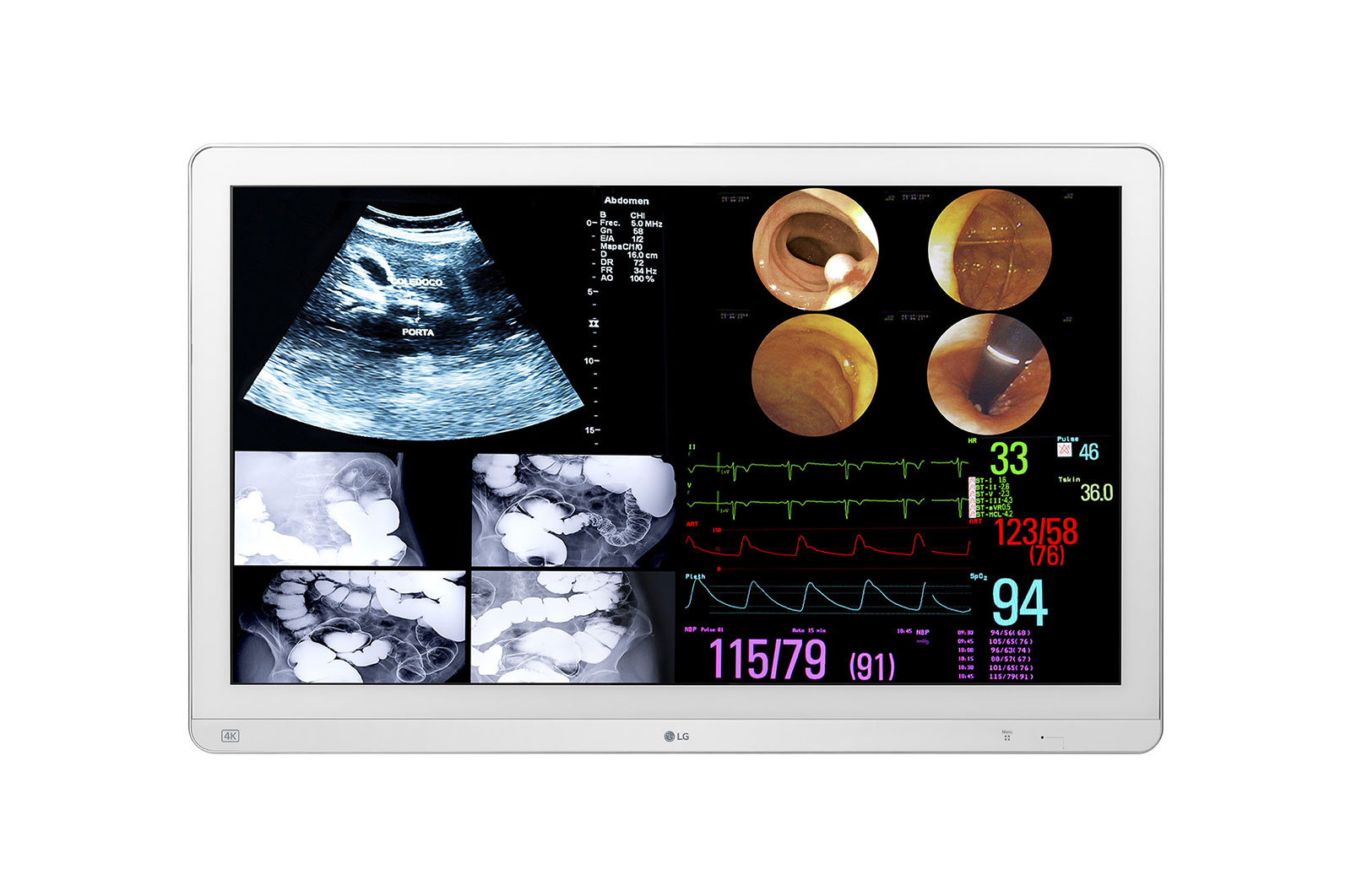 LG 31.5 (80.01cm) 4K IPS Surgical Monitor, 32HL714S-W