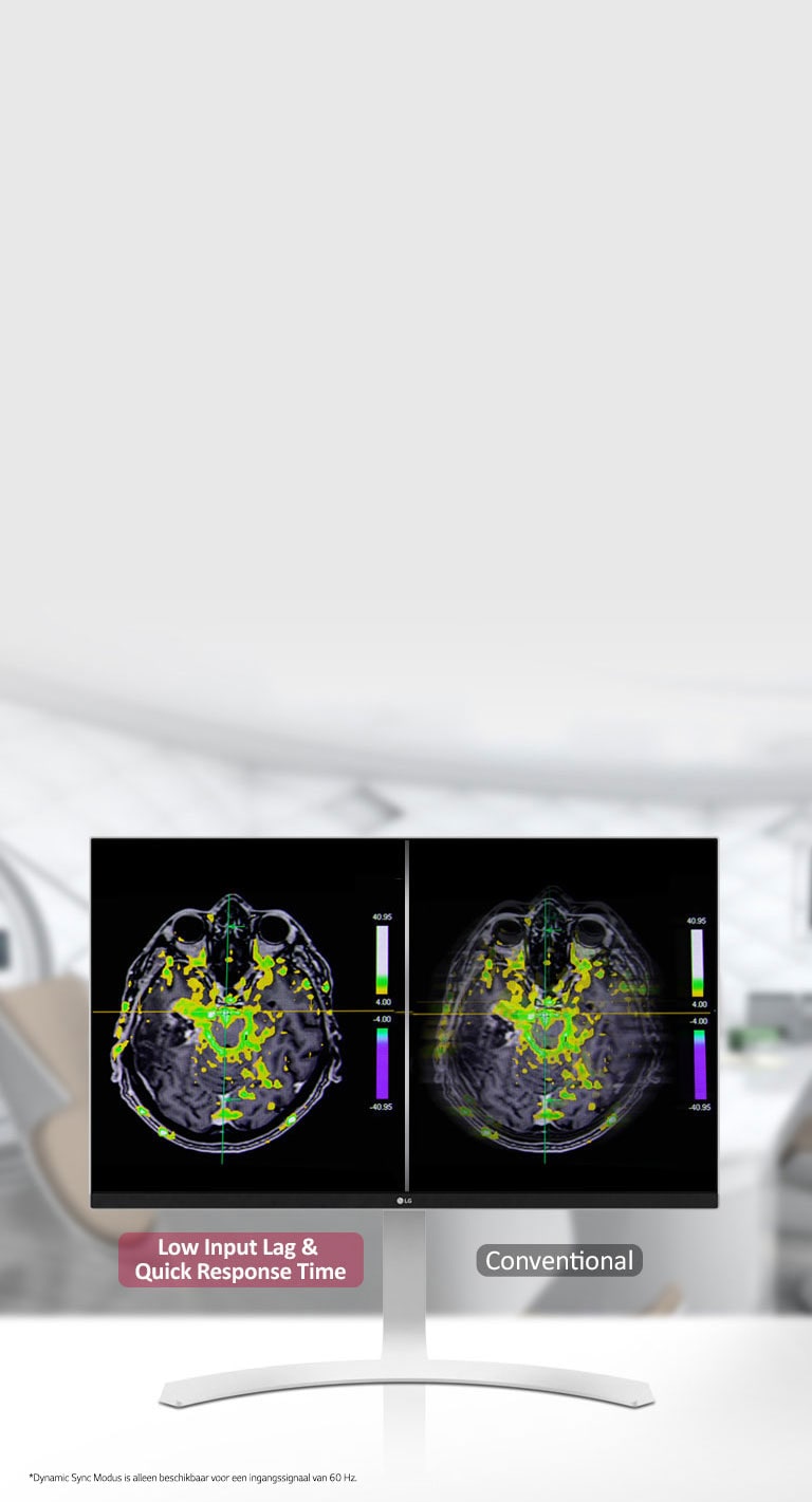 Dynamic Sync Modus en snelle reactietijd