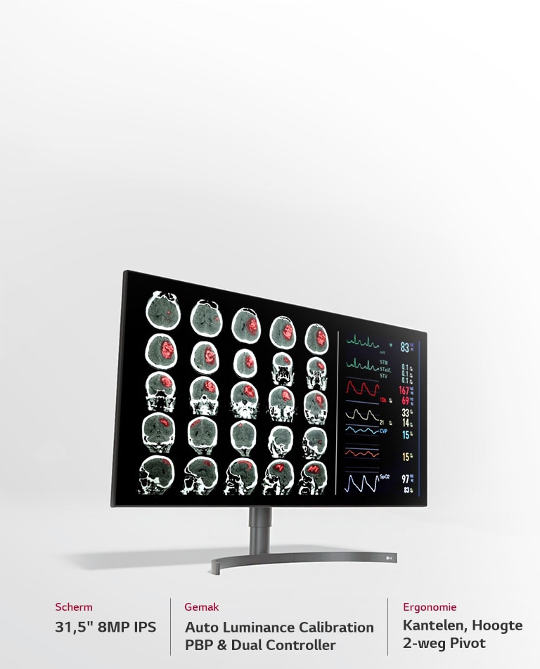 31.5" 8MP Diagnostische monitor3