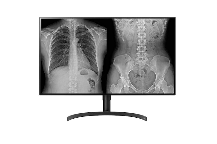 LG 31.5" LG 8MP Diagnostische monitor, 32HL512D-B