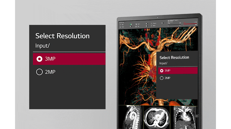 el Modo Multi-Resolución permite que los usuarios seleccionen la resolución de entrada entre 3mp y 2mp.