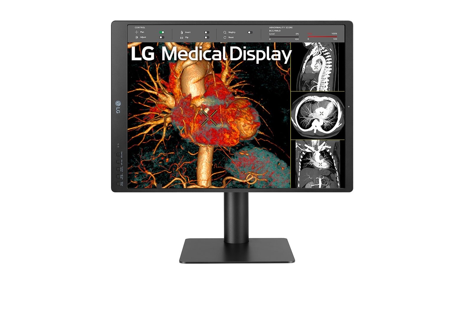 LG 21HQ513D - Monitor de Diagnóstico LG IPS 3MP, Modo Multi-Resolución, Modo Patológico, Auto Calibración; Ajustable en altura, giro e inclinación, 21HQ513D-B.AWM