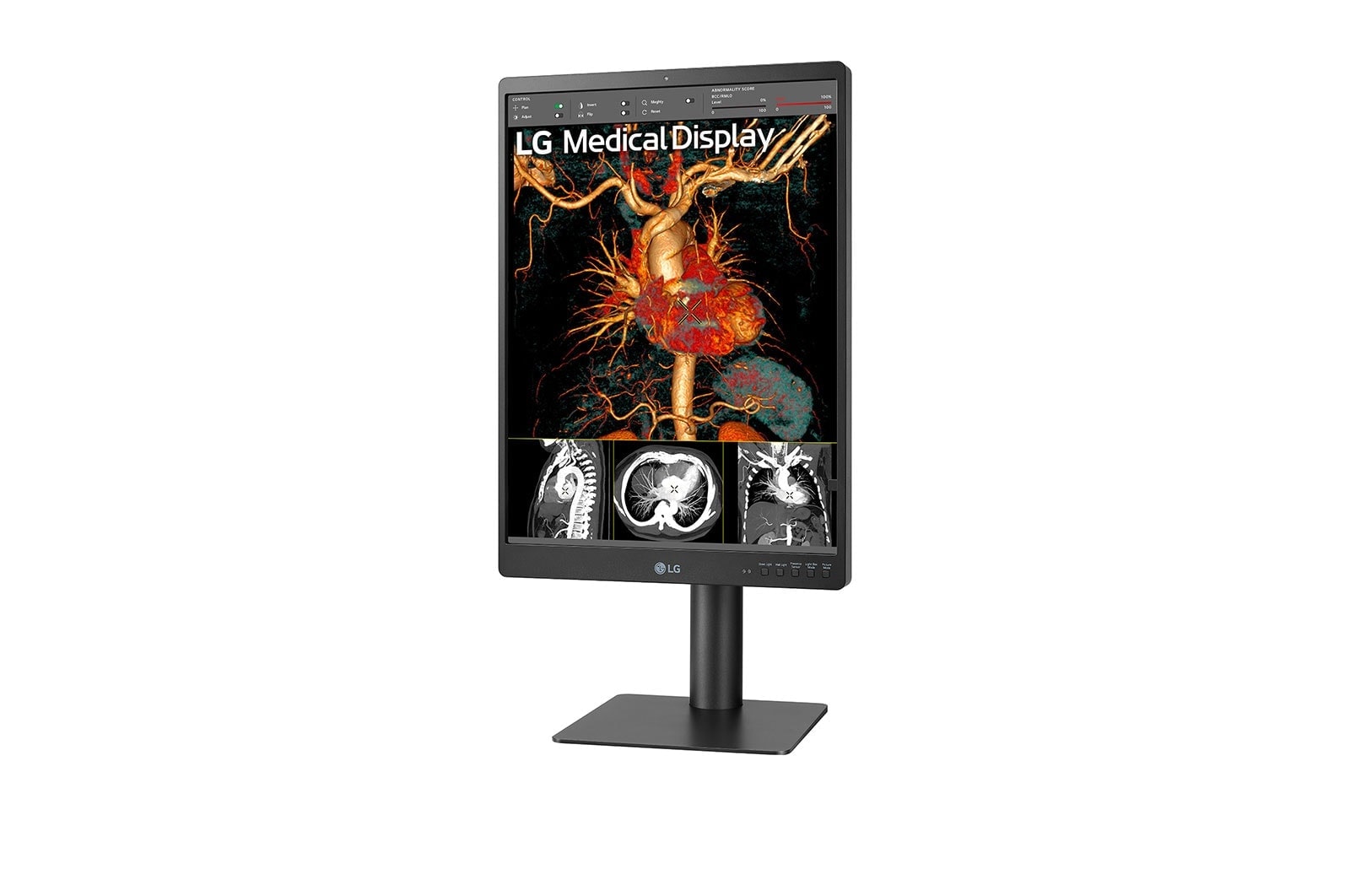 LG 21HQ513D - Monitor de Diagnóstico LG IPS 3MP, Modo Multi-Resolución, Modo Patológico, Auto Calibración; Ajustable en altura, giro e inclinación, 21HQ513D-B.AWM
