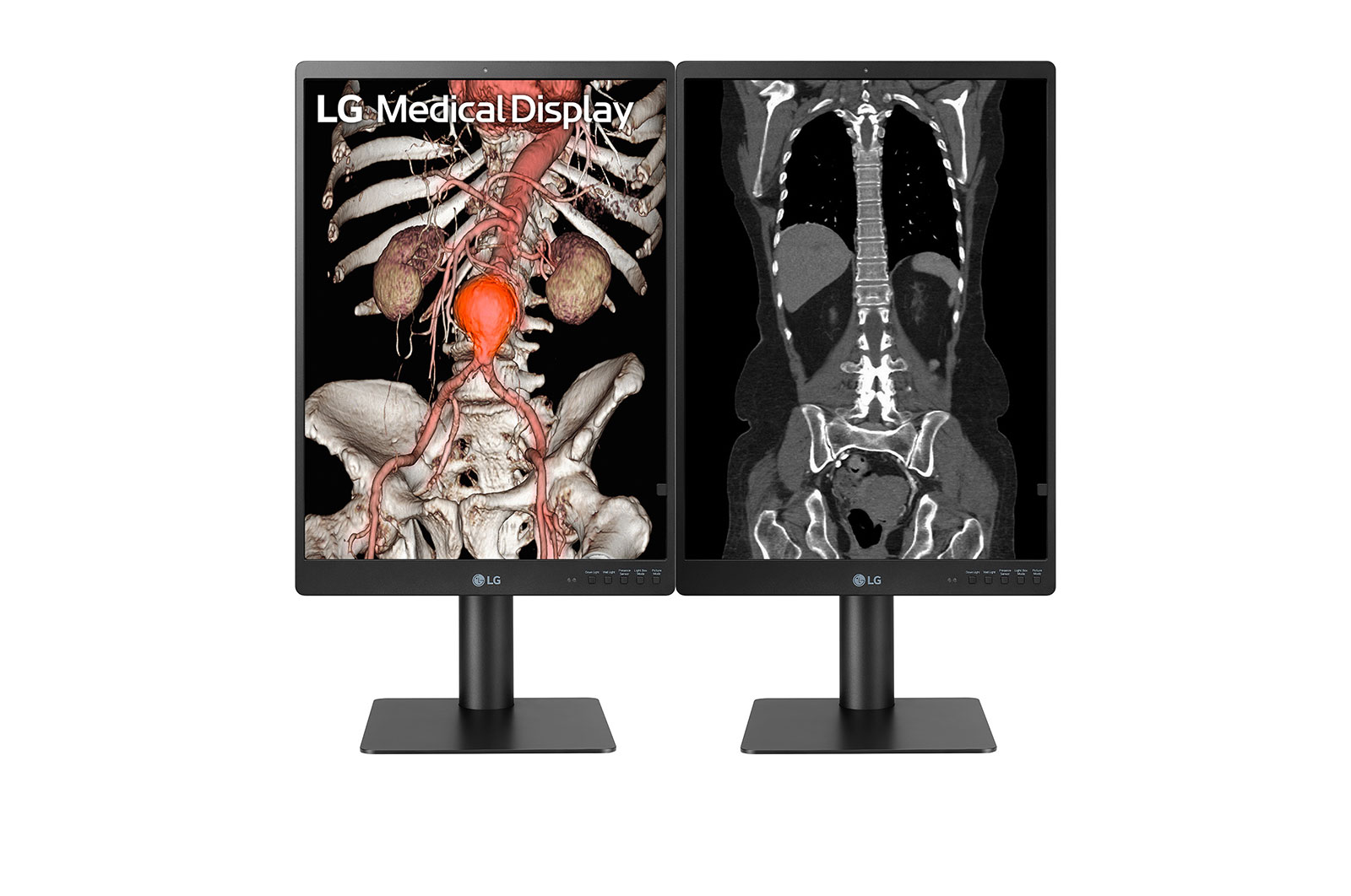 LG 21HQ513D - Monitor de Diagnóstico LG IPS 3MP, Modo Multi-Resolución, Modo Patológico, Auto Calibración; Ajustable en altura, giro e inclinación, 21HQ513D-B.AWM