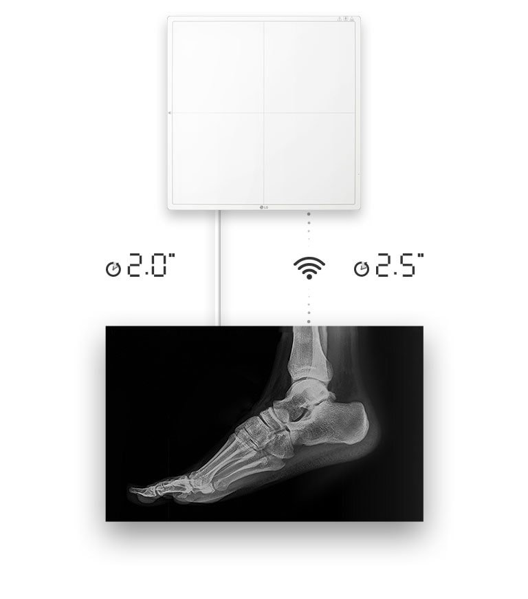 Disponibilidad de la imagen en 2 segundos con una conexión por cable o 2.5 segundos con una conexión inalámbrica para obtener una imagen en bruto