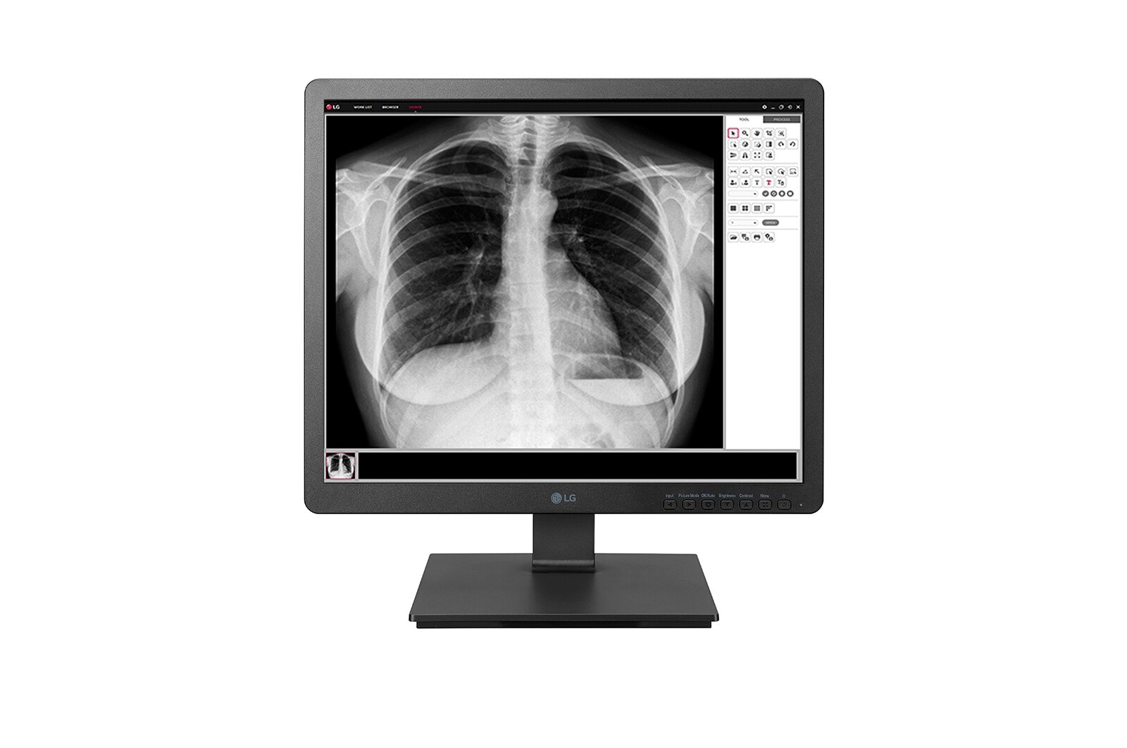 LG Monitor médico de 1.3MP 19HK312C, 19HK312C-B