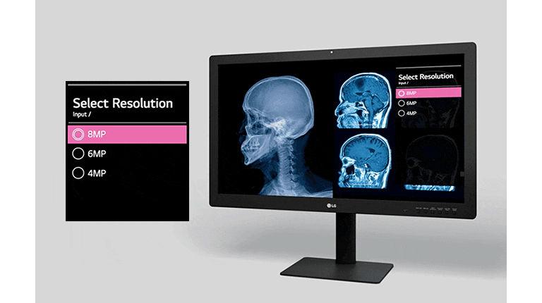 Zuverlässige Bildgebung für kritische Beurteilungen