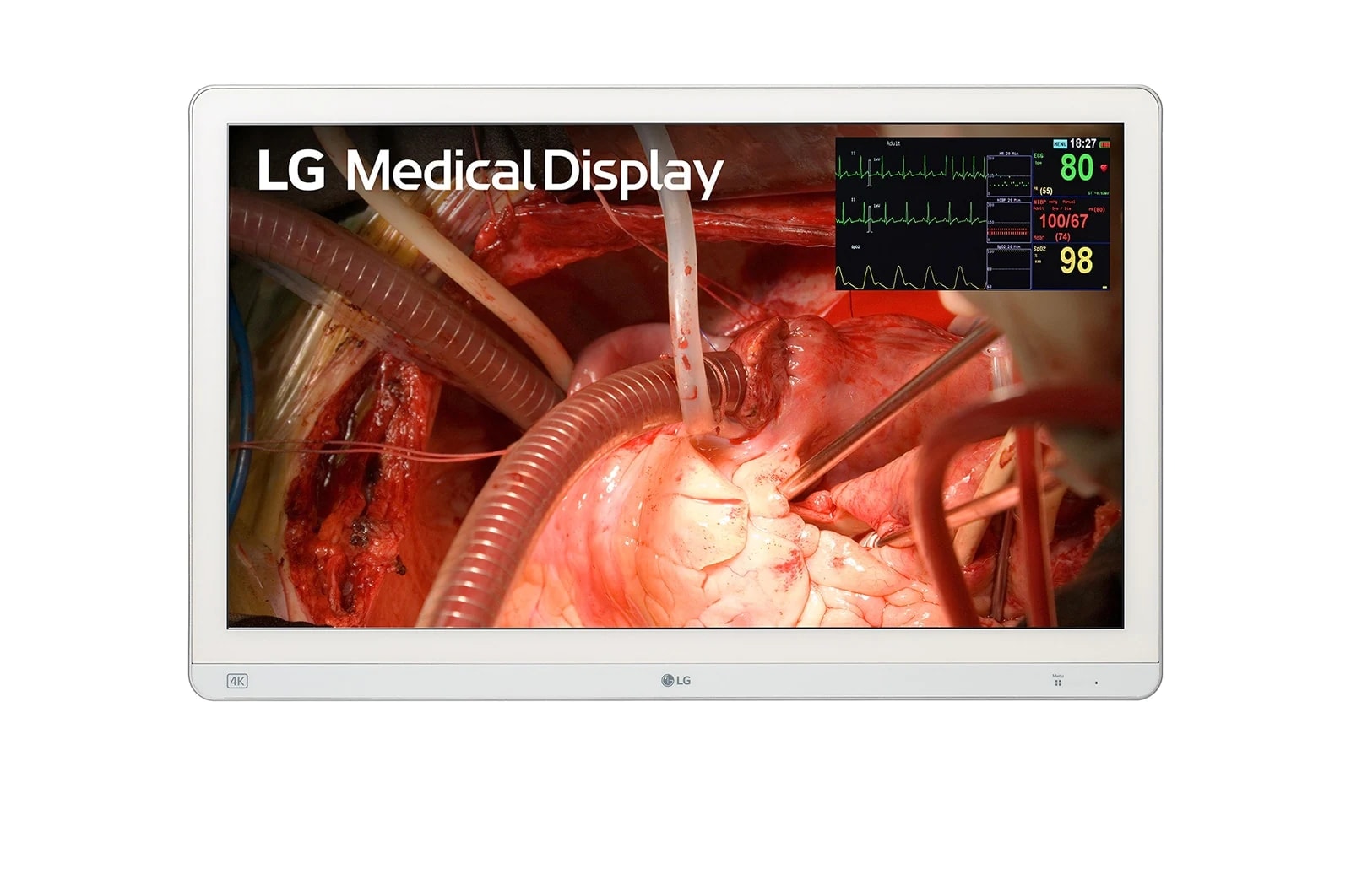 LG 27-inch 4K Surgical Monitor with Mini-LED, 27HQ710S-W