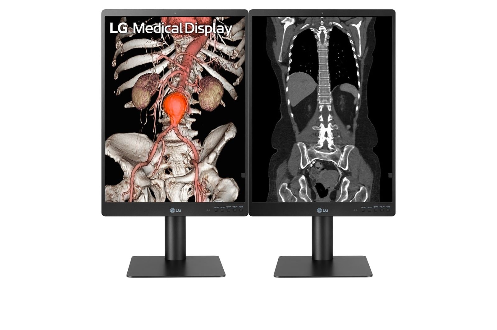 LG Diyagnostik Medikal Monitör 21,3 İnç 3MP Patoloji  Odak Görünümü Modu IPS Ekran, 21HQ513D-B