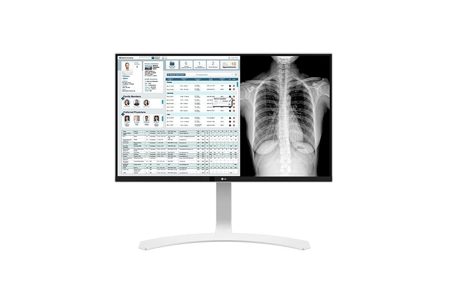 LG Klinik İnceleme Monitörü 27 İnç 8MP 3840x2160 UHD / IPS Ekran Tepki Süresi 14ms, 27HJ712C-W