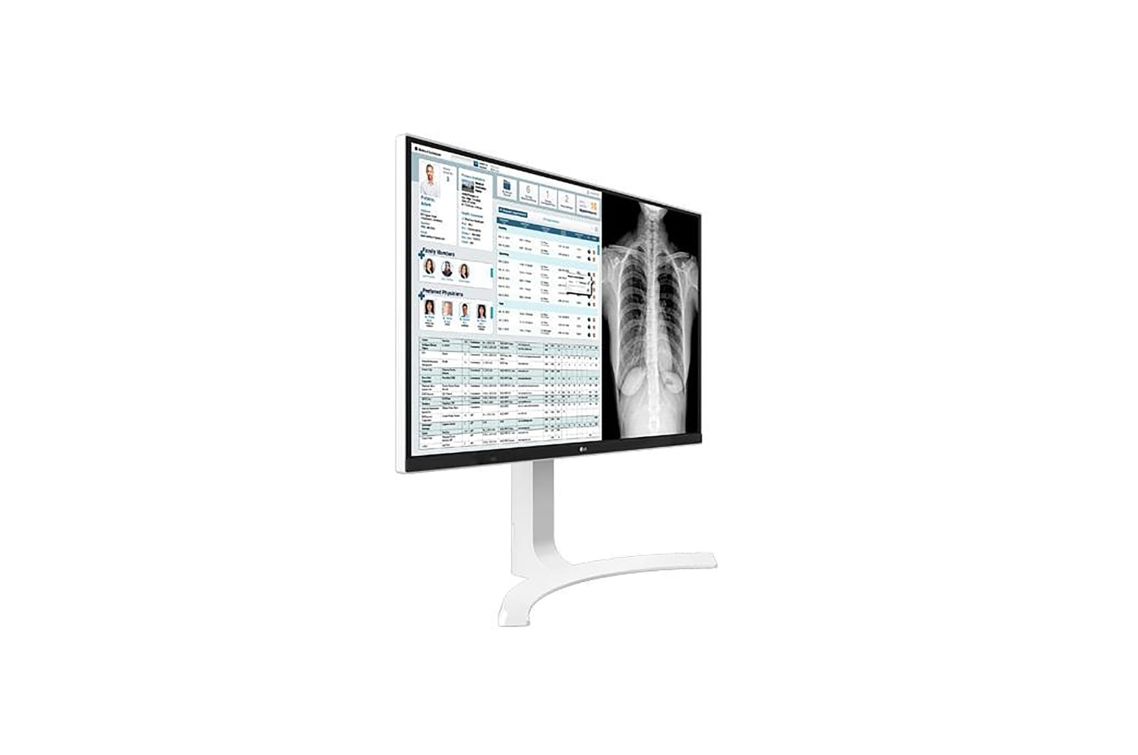 LG Klinik İnceleme Monitörü 27 İnç 8MP 3840x2160 UHD / IPS Ekran Tepki Süresi 14ms, 27HJ712C-W