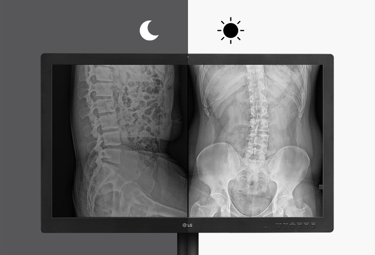 Ekran Parlaklığı Sağlar