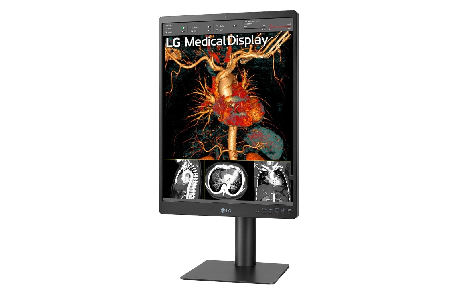 LG 21.3'' 3MP IPS Diagnostic Monitor, 21HQ513D-B