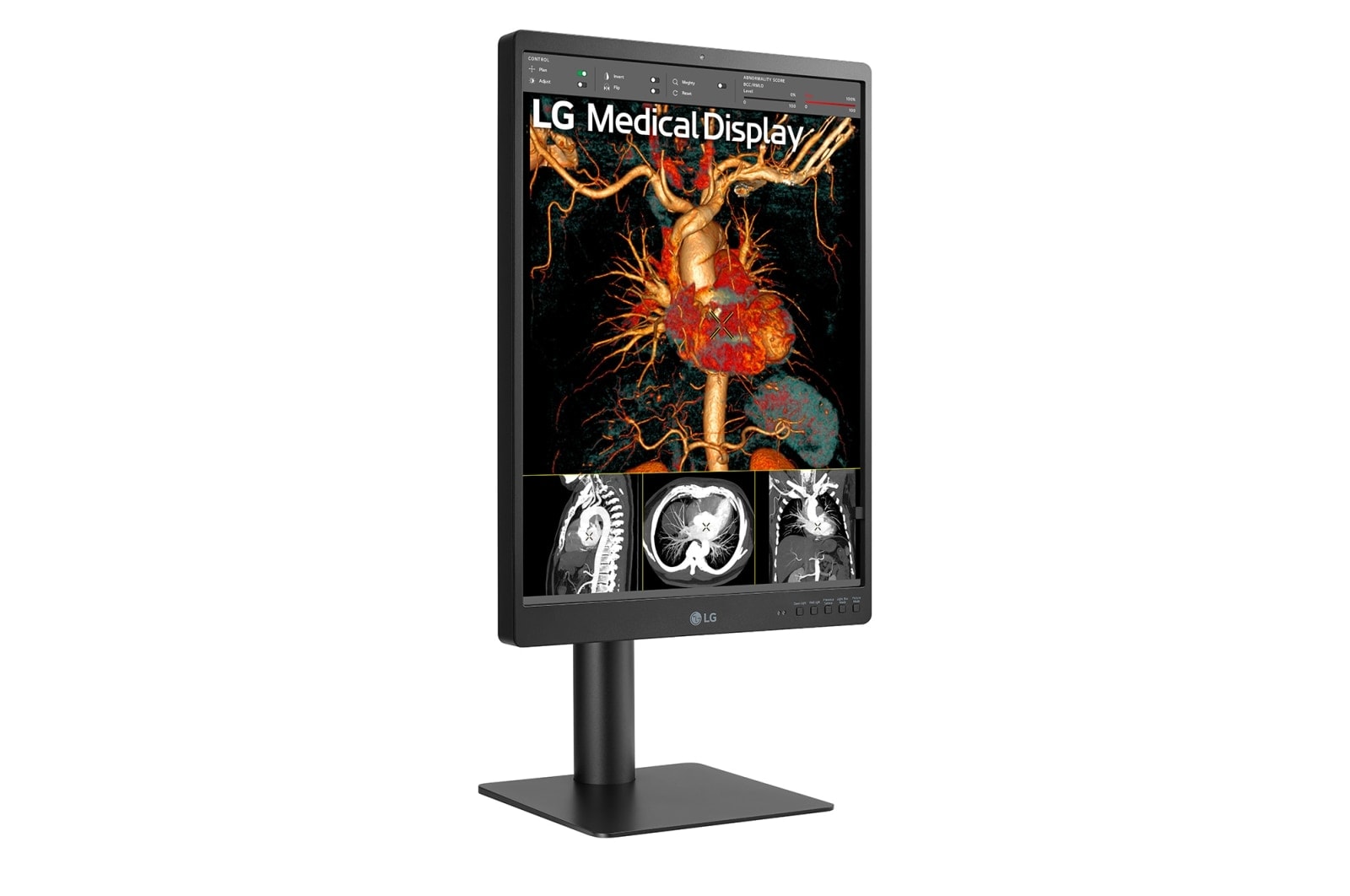 LG 21.3'' 3MP IPS Diagnostic Monitor, 21HQ513D-B