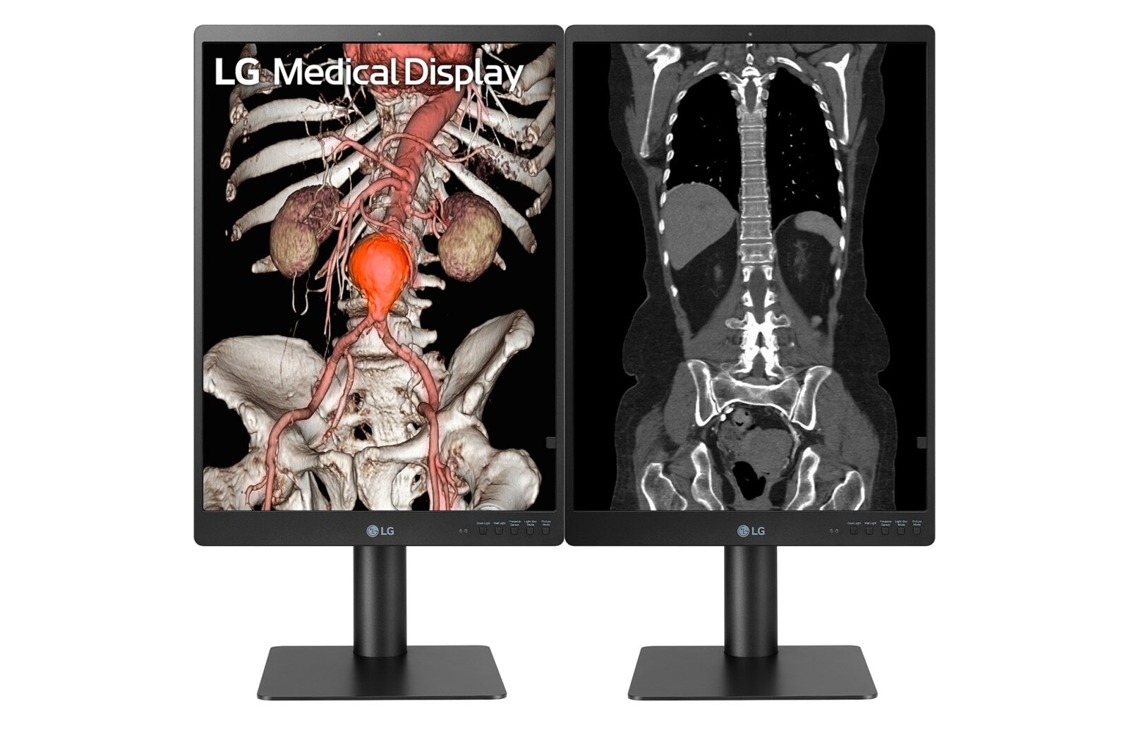LG 21.3'' 3MP IPS Diagnostic Monitor, 21HQ513D-B