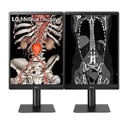 LG 21.3'' 3MP IPS Diagnostic Monitor, 21HQ513D-B