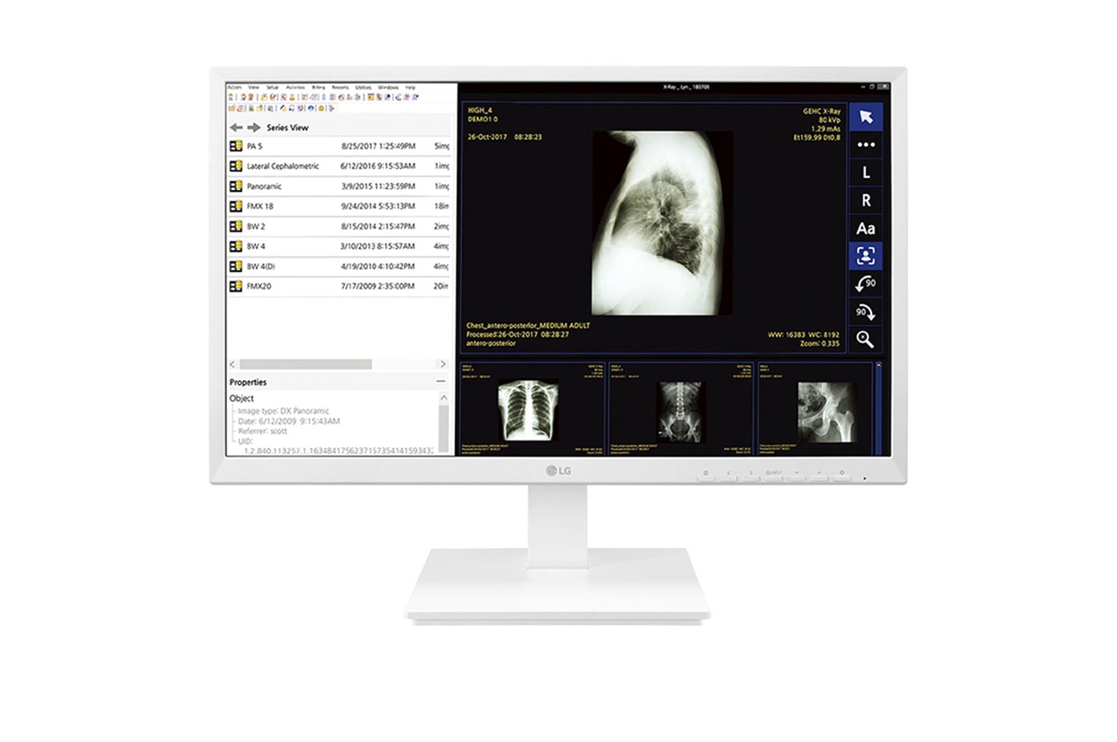 LG 24" All-in-One Thin Client for Healthcare, 24CK560N-3A