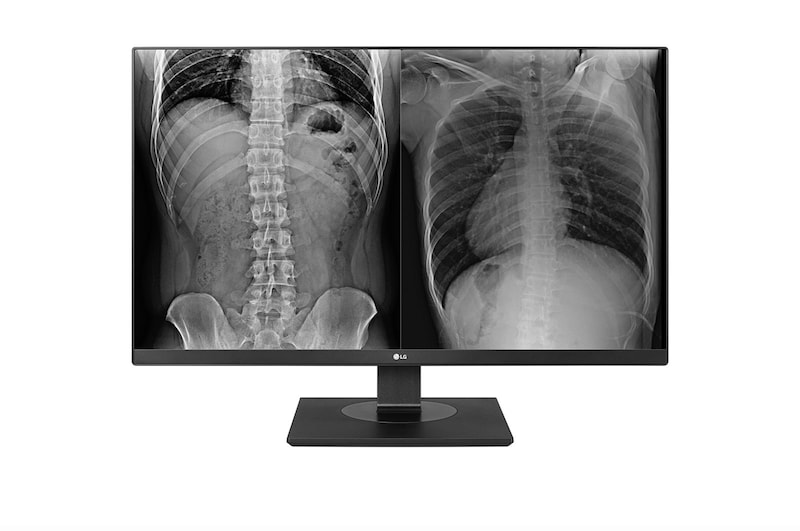 LG 27" LG 8MP Clinical Review Monitor, 27HJ713C-B