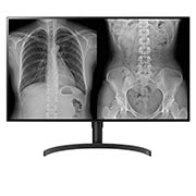 LG 31.5" LG 8MP Diagnostic Monitor, 32HL512D-B