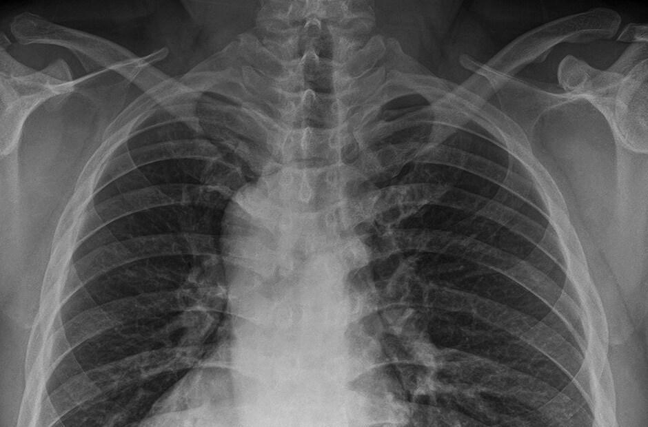 x-ray image 3.