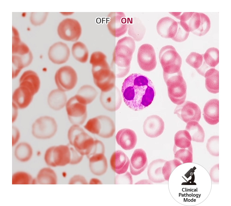 Clinical Pathology Mode