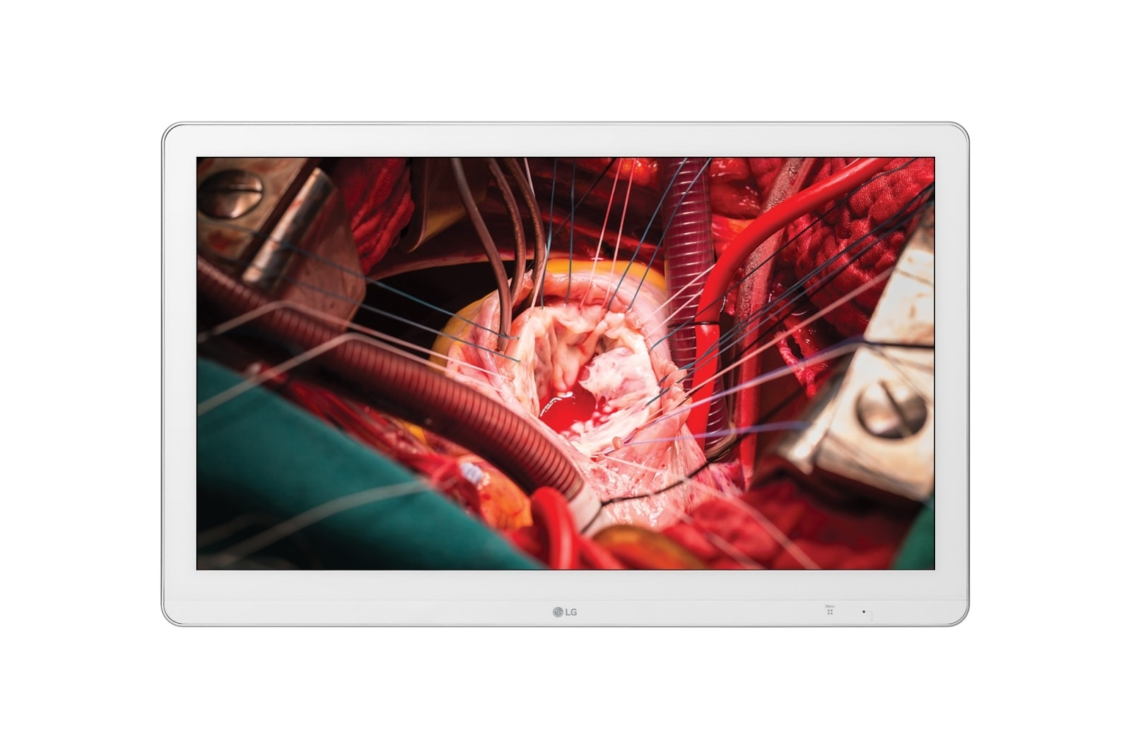 LG Màn hình phẫu thuật 27" LG Full HD, 27HK510S-W