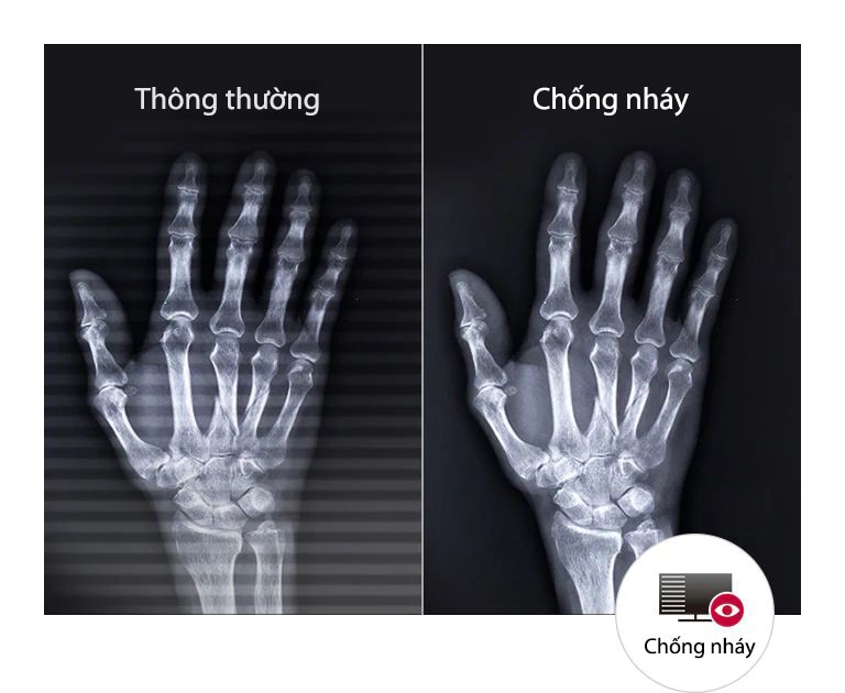 Giúp mắt thoải mái lâu dài