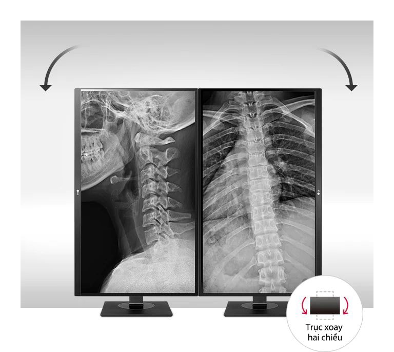 Thiết kế thuận tiện