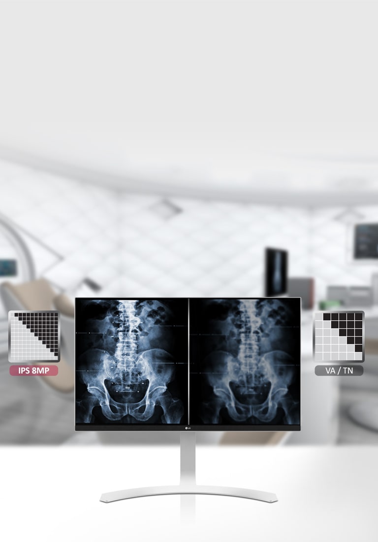 Màn hình y tế IPS 8MP<br>1