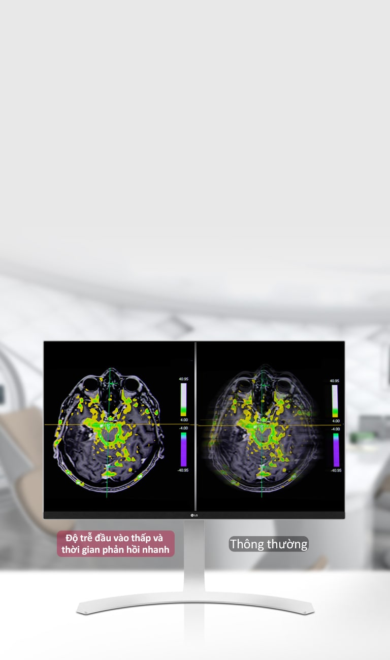 Chế độ đồng bộ động và thời gian phản hồi nhanh1