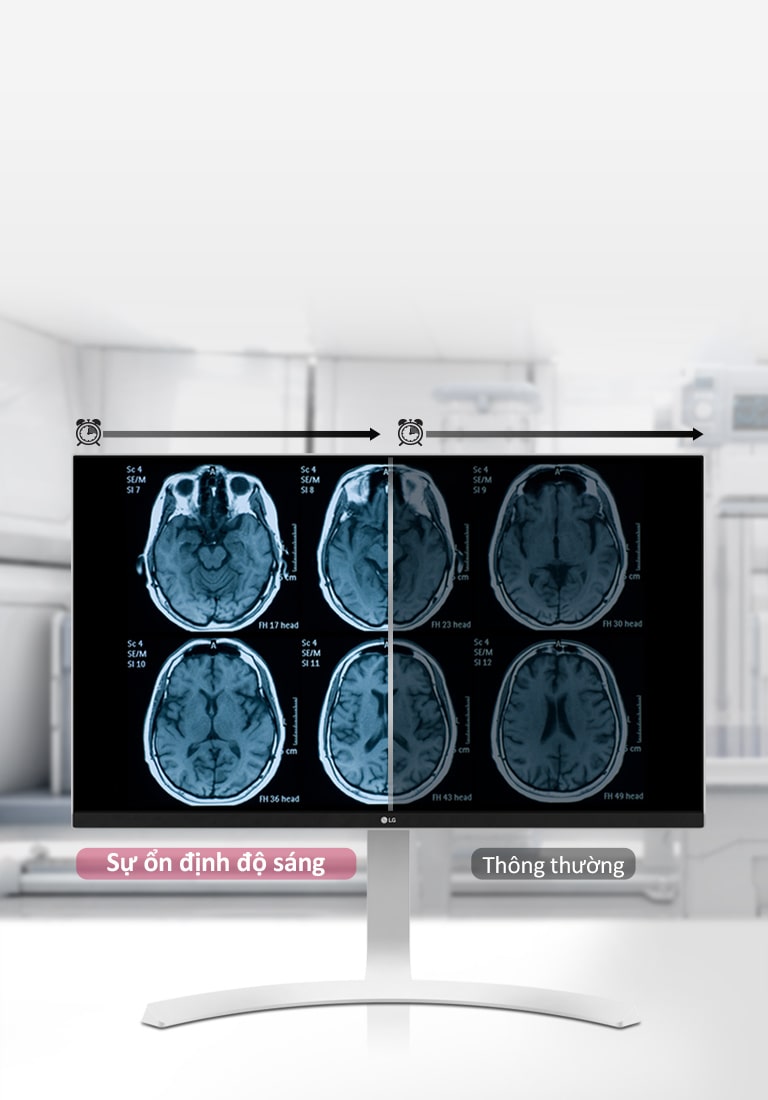 Sự ổn định độ sáng1