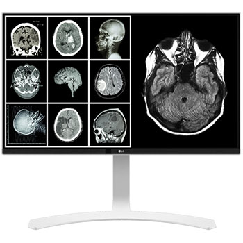 8MP Clinical Review Monitor