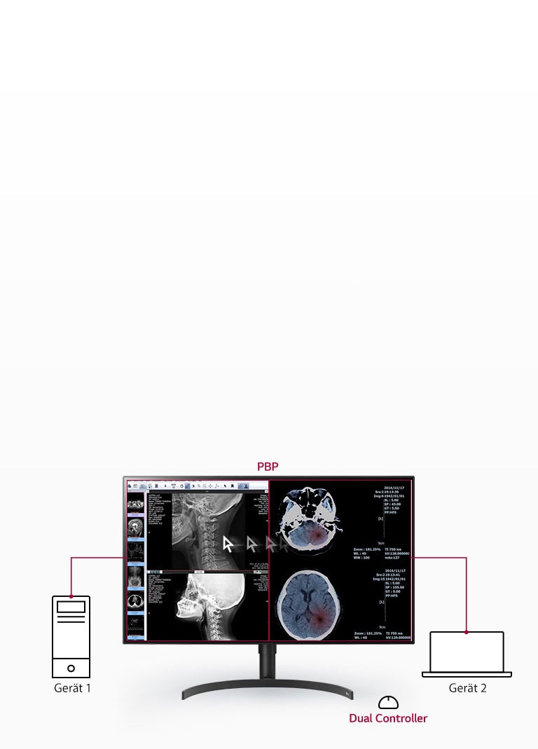 Mehrere Signale auf einem Bildschirm1