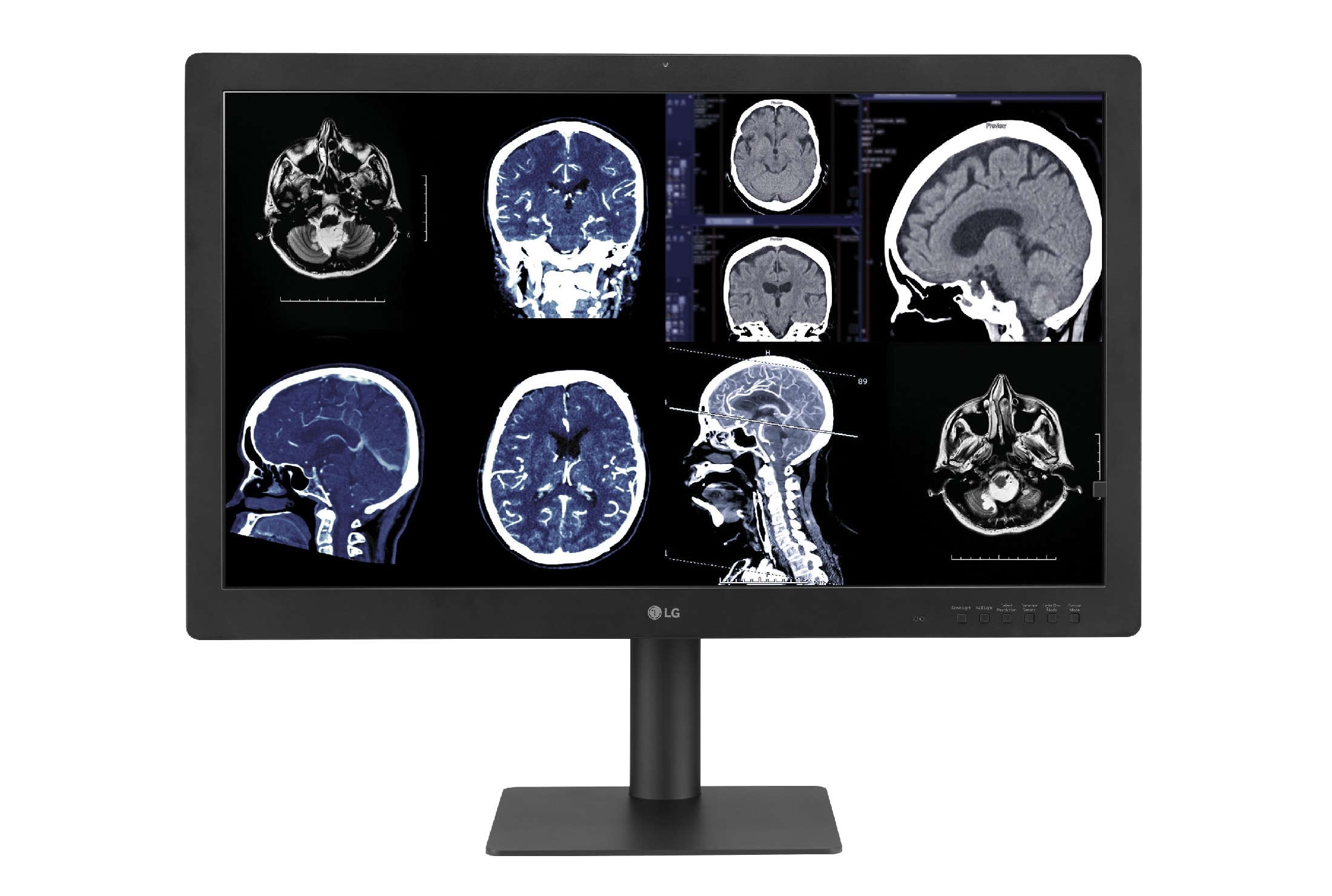 LG’s New Diagnostic Monitor With IPS Black Delivers Reliable Image Quality
