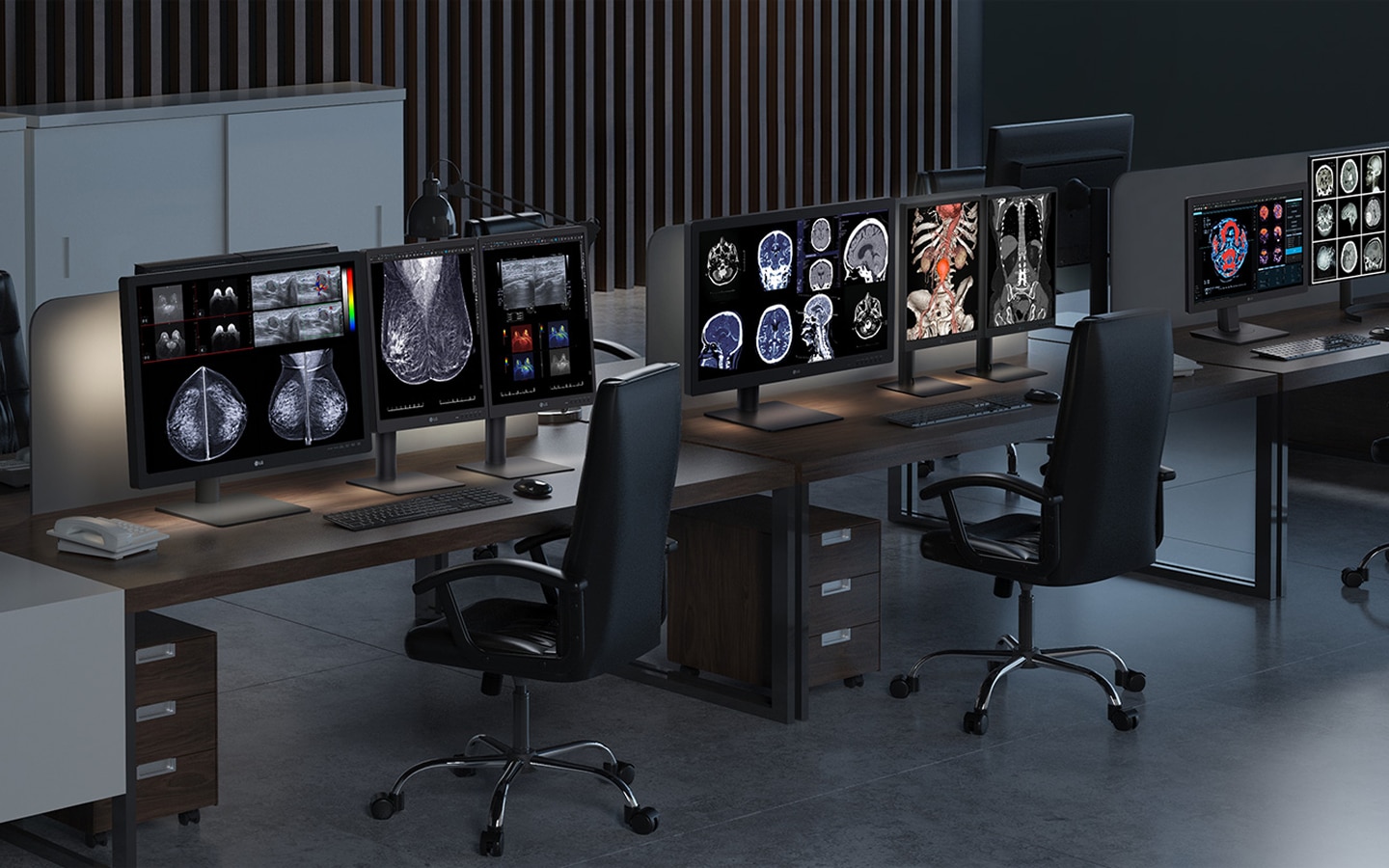 LG medical monitors displaying high-resolution breast and brain MRI scans in a hospital reading room. Optimized for diagnostic accuracy and radiology workflows.