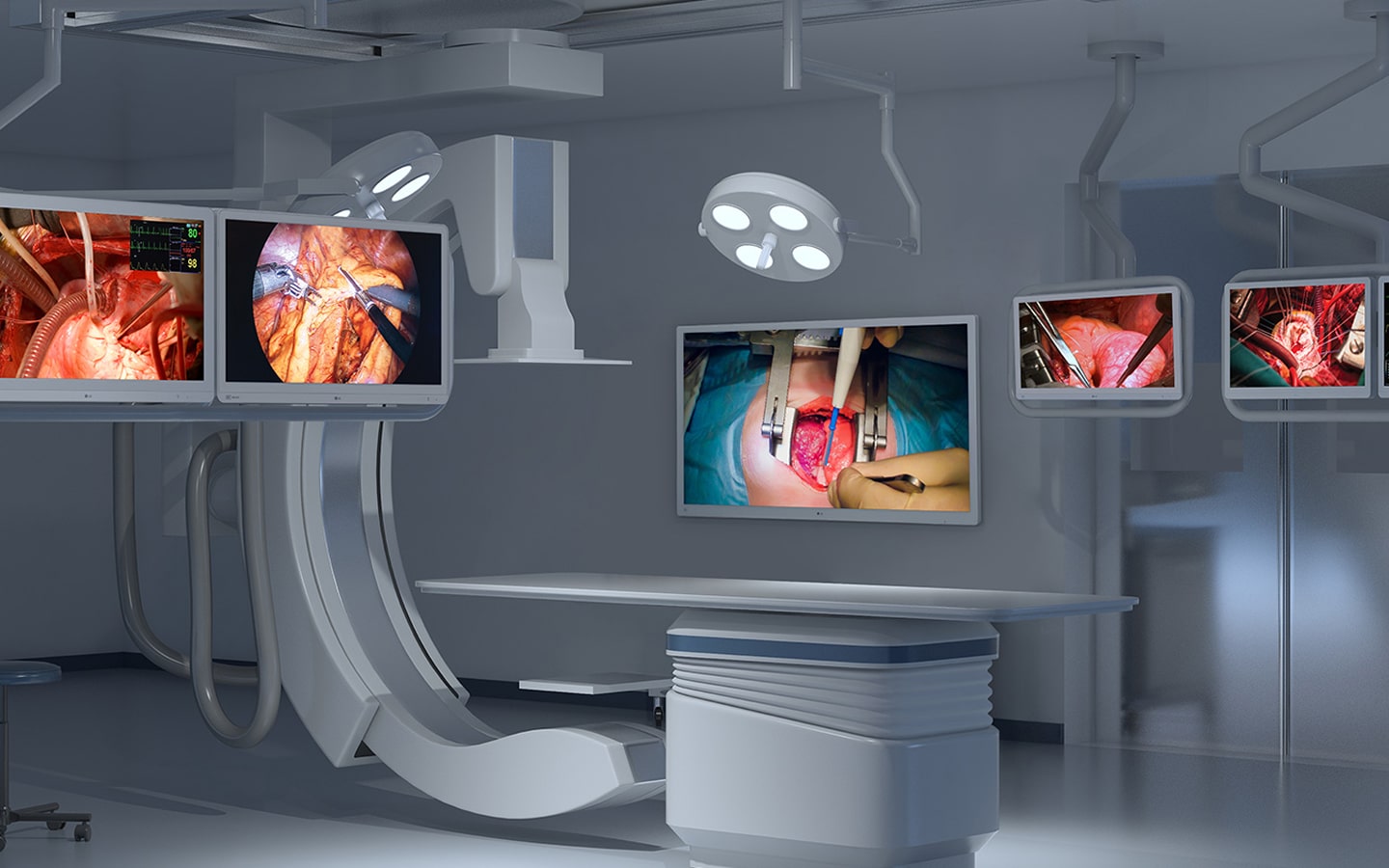 LG medical monitors installed in a modern operating room, showing multiple live surgery feeds. Delivering reliable visualization for surgical teams.