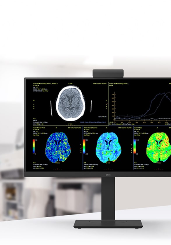 Close-up of LG clinical monitor showing multi-color brain imaging scans for neurological assessment.