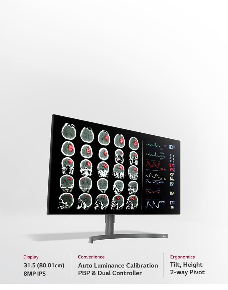 31.5 (80.01cm) 8MP Diagnostic Monitor