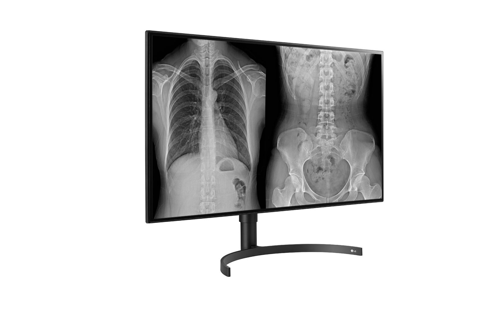 LG 31.5 (80.01cm) UHD 8MP Diagnostic Monitor, 32HL512D-B