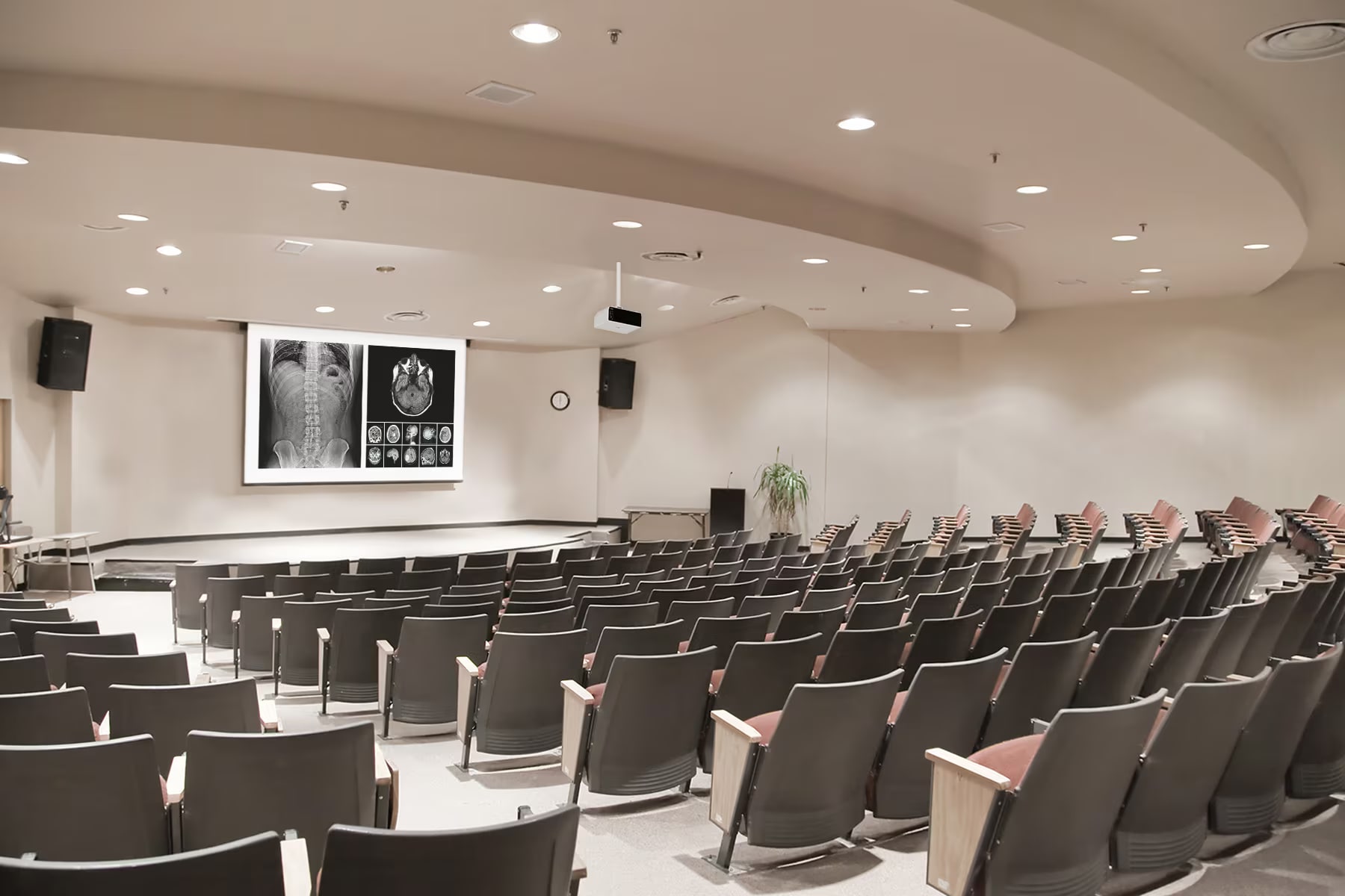 BF50 se instala en el techo de la sala de conferencias médicas